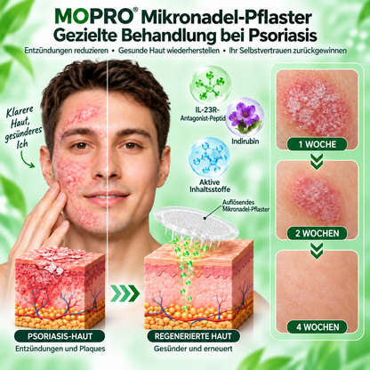 𝐌𝐎𝐏𝐑𝐎® 💟💟 𝐈𝐋-𝟐𝟑𝐑-𝐀𝐧𝐭𝐚𝐠𝐨𝐧𝐢𝐬𝐭-𝐏𝐞𝐩𝐭𝐢𝐝 + 𝐈𝐧𝐝𝐢𝐫𝐮𝐛𝐢𝐧 𝟏𝟎-𝐈𝐍-𝟏 𝐍𝐚𝐧𝐨-𝐌𝐢𝐤𝐫𝐨𝐧𝐚𝐝𝐞𝐥-𝐏𝐟𝐥𝐚𝐬𝐭𝐞𝐫 (𝐇𝐢𝐥𝐟𝐭 𝐛𝐞𝐢 𝐑ö𝐭𝐮𝐧𝐠𝐞𝐧, 𝐒𝐜𝐡𝐮𝐩𝐩𝐮𝐧𝐠, 𝐓𝐫𝐨𝐜𝐤𝐞𝐧𝐡𝐞𝐢𝐭 & 𝐉𝐮𝐜𝐤𝐫𝐞𝐢𝐳 𝐮𝐧𝐝 𝐮𝐧𝐭𝐞𝐫𝐬𝐭ü𝐭𝐳𝐭 𝐇𝐚𝐮𝐭𝐞𝐫𝐧𝐞𝐮𝐞𝐫𝐮𝐧𝐠 & 𝐇𝐚𝐮𝐭𝐛𝐚𝐫𝐫𝐢𝐞𝐫𝐞.)