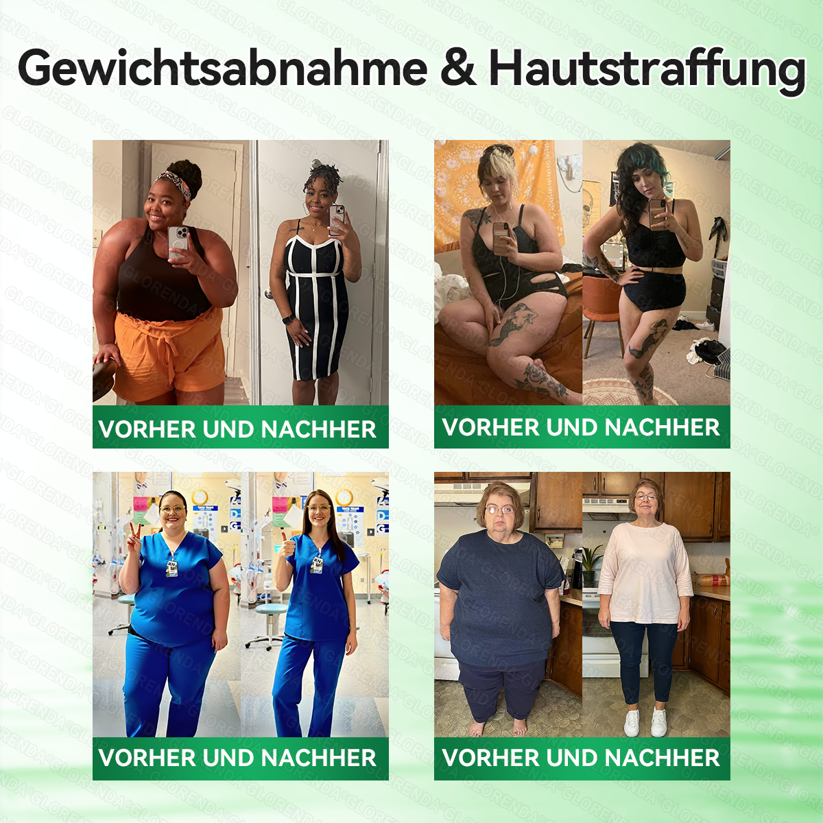 🔥🔥 Kaufen Sie mehr als 10 Packungen und sparen Sie 30%! GLORENDA® Mikronadel-Pflaster sind sicher und getestet. Mit 4–6 Packungen unterstützen Sie Gewichtsmanagement, Blutzuckerregulation, Verdauungsgesundheit und langanhaltende Energie!