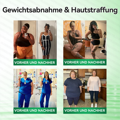 🔥🔥 Kaufen Sie mehr als 10 Packungen und sparen Sie 30%! GLORENDA® Mikronadel-Pflaster sind sicher und getestet. Mit 4–6 Packungen unterstützen Sie Gewichtsmanagement, Blutzuckerregulation, Verdauungsgesundheit und langanhaltende Energie!