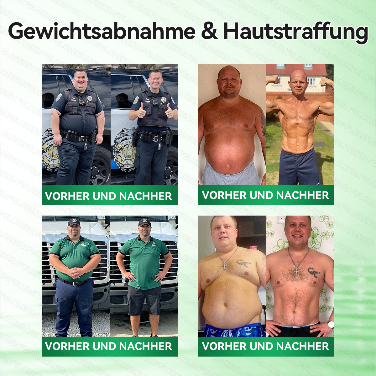 🔥🔥 Kaufen Sie mehr als 10 Packungen und sparen Sie 30%! GLORENDA® Mikronadel-Pflaster sind sicher und getestet. Mit 4–6 Packungen unterstützen Sie Gewichtsmanagement, Blutzuckerregulation, Verdauungsgesundheit und langanhaltende Energie!