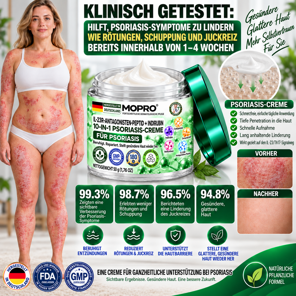 🔥 Nur noch 10 Stück verfügbar! Erhalten Sie 30 % Rabatt auf Ihren zweiten Einkauf! MOPRO® hilft, sichtbare Schuppenbildung, Rötungen, Trockenheit und Juckreiz zu reduzieren und unterstützt gleichzeitig psoriasisgeplagte Haut. 💚