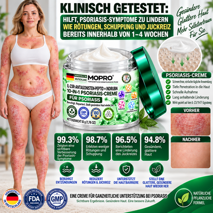 🔥 Nur noch 10 Stück verfügbar! Erhalten Sie 30 % Rabatt auf Ihren zweiten Einkauf! MOPRO® hilft, sichtbare Schuppenbildung, Rötungen, Trockenheit und Juckreiz zu reduzieren und unterstützt gleichzeitig psoriasisgeplagte Haut. 💚