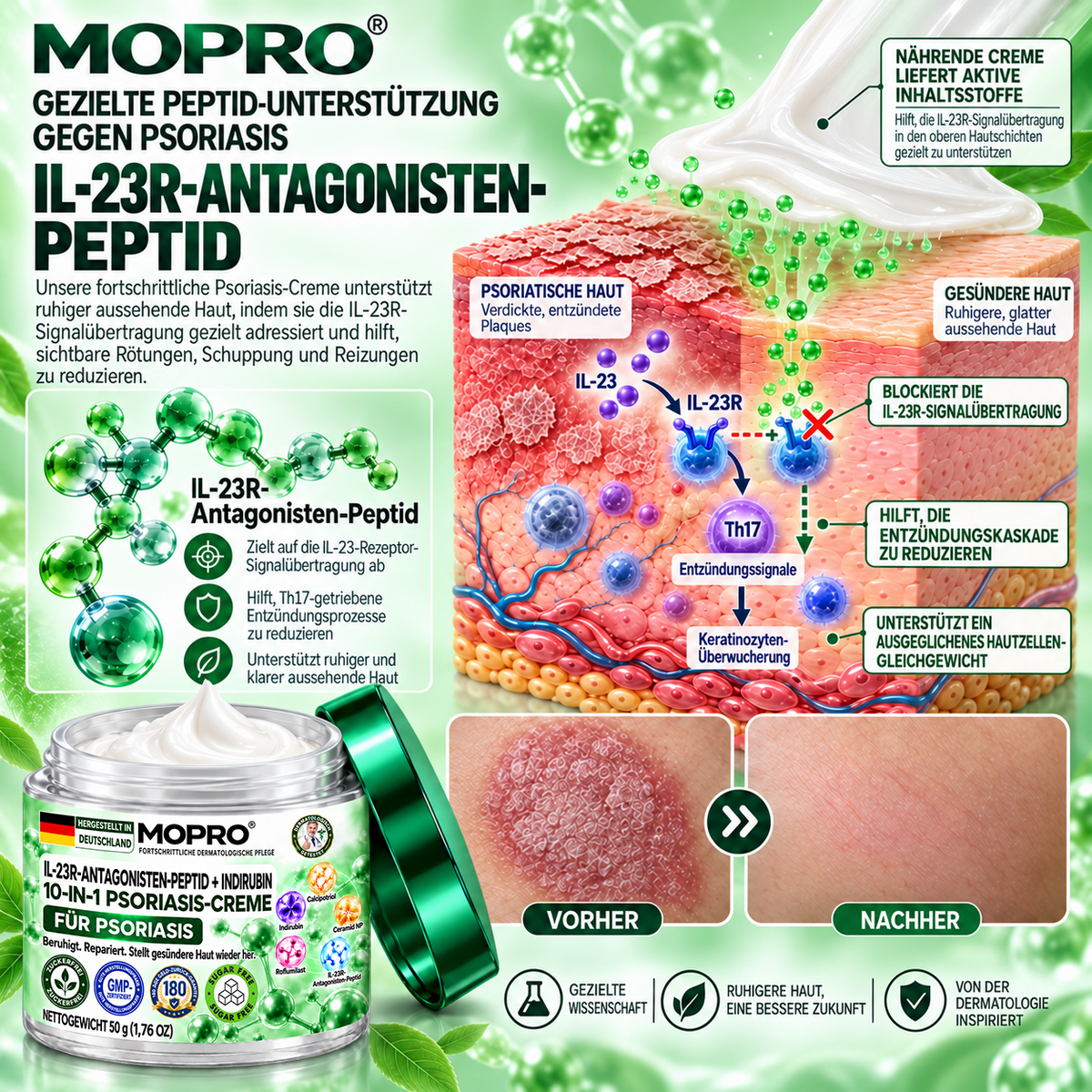 🔥 Nur noch 10 Stück verfügbar! Erhalten Sie 30 % Rabatt auf Ihren zweiten Einkauf! MOPRO® hilft, sichtbare Schuppenbildung, Rötungen, Trockenheit und Juckreiz zu reduzieren und unterstützt gleichzeitig psoriasisgeplagte Haut. 💚